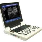 Ultrasound Machine ORIEL NOTEBOOK