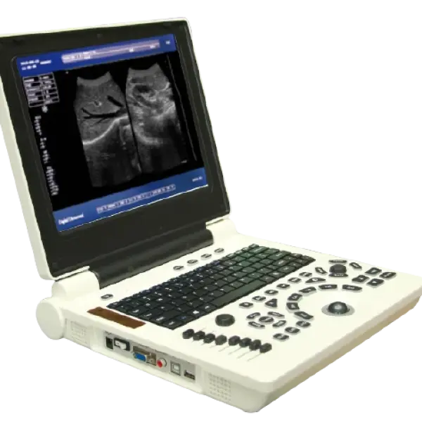 Ultrasound Machine ORIEL NOTEBOOK